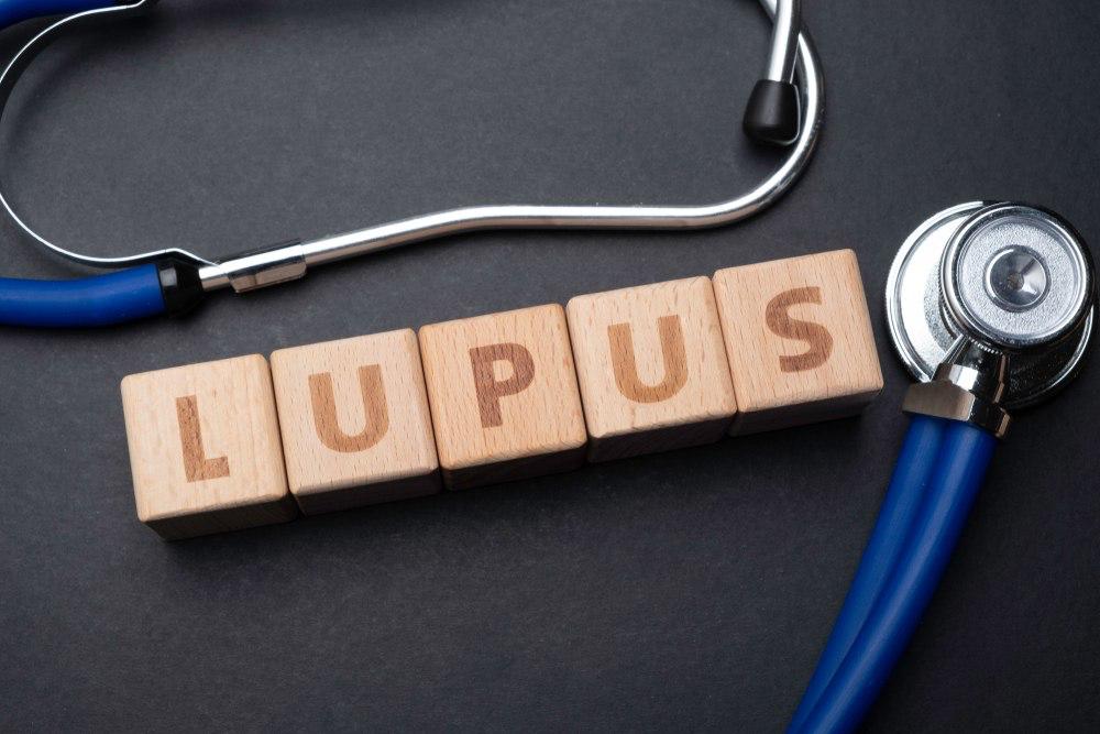 Como o Lúpus, uma doença autoimune,  pode afetar a sua saúde.
